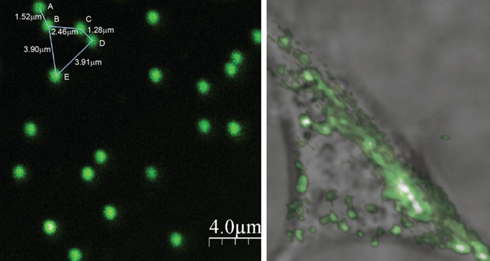 Images of single UCNPs and UCNPs within a cell